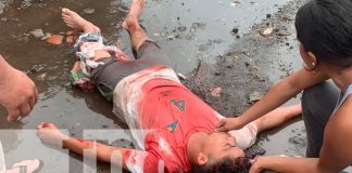 Foto; Hombre machetea a su cuñado en Chinandega / TN8