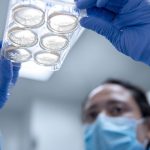 Investigación de ‘minicerebros’ plantea nueva teoría sobre el autismo Foto: "Minicerebros" y autismo /cortesía