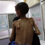 3,000 pequeños en peligro de muerte por desnutrición aguda en Gaza Foto: Niños están en peligro de morir en Gaza por desnutrición /Cortesía