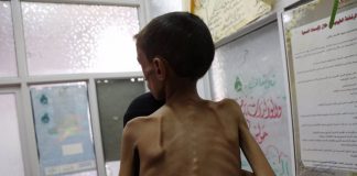Foto: Niños están en peligro de morir en Gaza por desnutrición /Cortesía