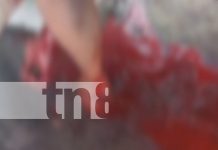Brutal ataque con machete en Rivas deja a hombre gravemente herido Foto: Brutal ataque con machete en Rivas deja a hombre gravemente herido/TN8