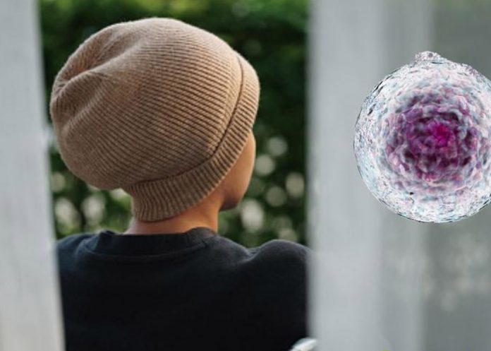 De alergia a cáncer De alergia a cáncer