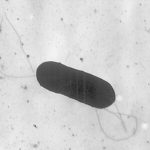 Foto: Alerta sanitaria en Estados Unidos /cortesía