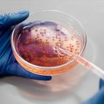 Foto: En Estados Unidos investigan brote de infecciones por Listeria/Cortesía