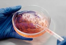 Foto: En Estados Unidos investigan brote de infecciones por Listeria/Cortesía
