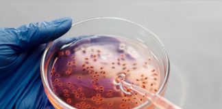 Foto: En Estados Unidos investigan brote de infecciones por Listeria/Cortesía