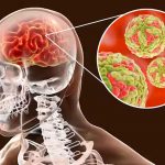 En India investigan aparición de casos de virus Chandipura y encefalitis Foto: India, investiga aparición de casos de virus Chandipura y encefalitis/Cortesía