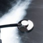 Foto: Hombre descubre la causa de su tos /cortesía