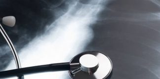 Foto: Hombre descubre la causa de su tos /cortesía