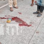 Niña de 7 años gravemente herida tras ser atropellada en Siuna Foto: Niña de 7 años gravemente herida tras ser atropellada en Siuna/TN8