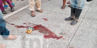 Foto: Niña de 7 años gravemente herida tras ser atropellada en Siuna/TN8