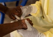 Foto: África declara emergencia sanitaria por brotes de mpox en 13 países