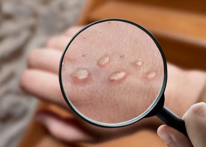 Foto: Emergencia en Suecia /cortesía Foto: Emergencia en Suecia /cortesía