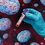 ¡Expertos advierten! La gonorrea podría convertirse en una amenaza incurable Foto: La gonorrea no tratada puede provocar problemas de salud graves/Cortesía