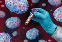 ¡Expertos advierten! La gonorrea podría convertirse en una amenaza incurable Foto: La gonorrea no tratada puede provocar problemas de salud graves/Cortesía