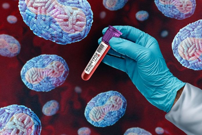 Foto: La gonorrea no tratada puede provocar problemas de salud graves/Cortesía Foto: La gonorrea no tratada puede provocar problemas de salud graves/Cortesía