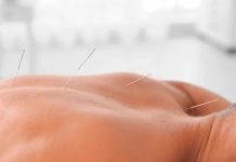 Mujer que aprendió acupuntura viendo videos en línea mata a un paciente Foto: Mujer que aprendió acupuntura viendo videos mata a un paciente/Cortesía