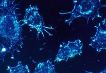 ¡Increíble! Desarrollan nueva IA que permite el diagnóstico del cáncer Foto: IA avanzada y el cáncer /cortesía