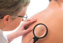 ¡Avances! Nueva prueba indolora detectaría en segundos el ‘Cáncer de piel’ Foto: Nueva prueba indolora de detección del cáncer de piel/Cortesía
