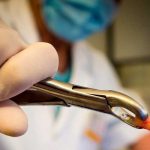 Insólito: un hombre fallece tras someterse a la extracción de 23 dientes Huang falleció debido a un infarto trece días después de someterse a una intervención dental en el Hospital Dental Yongkang Deway, en Jinhua