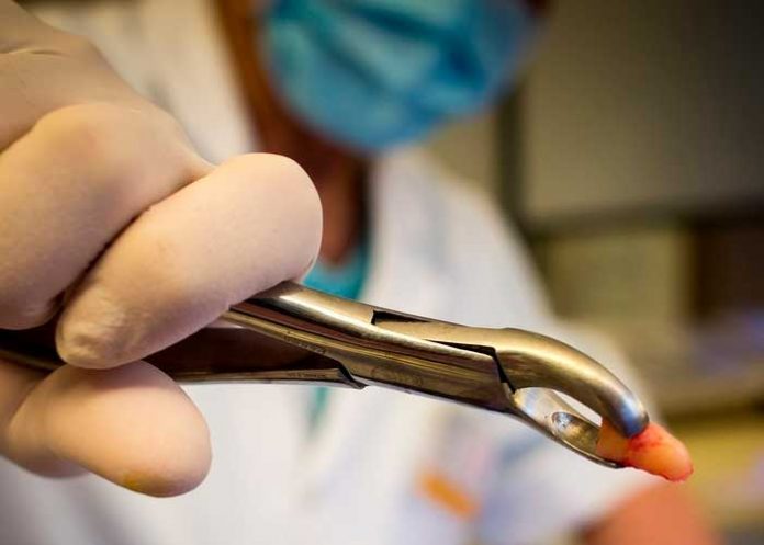 6 Huang falleció debido a un infarto trece días después de someterse a una intervención dental en el Hospital Dental Yongkang Deway, en Jinhua