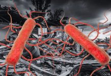 Alarma en Florida: infección de bacteria ‘carnívora’ lleva 13 muertos Foto: Alerta en Florida por infecciones de bacteria 'carnívora' /Cortesía