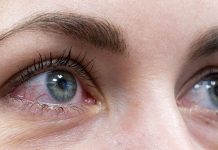Alerta en EE.UU.: muere la primera persona por virus que hace sangrar los ojos Foto: Una persona muere en EE.UU. por un virus /Cortesía