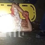 Carazo: Motorizado pierde una pierna tras sufrir accidente de tránsito Foto: Un motorizado pierde una pierna tras brutal accidente en Jinotepe, Carazo / TN8