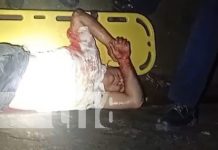 Carazo: Motorizado pierde una pierna tras sufrir accidente de tránsito Foto: Un motorizado pierde una pierna tras brutal accidente en Jinotepe, Carazo / TN8