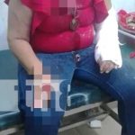 Delincuente en Chichigalpa roba a una mujer y la agrede con machete Foto: Agresión a una mujer en Chichigalpa, Chinandega / TN8