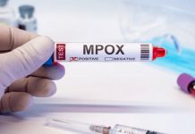 EE.UU. detecta primer caso de viruela del mono por la cepa más contagiosa Foto: contagio por la cepa más agresiva de la viruela del mono/Cortesía