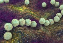 Hombre queda sin nalga por una bacteria «comecarne» Foto: Bacteria letal /cortesía
