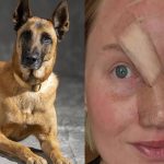 Perro le arranca la nariz de su dueña por el pánico de los fuegos artificiales Foto: Le arranca la nariz a su dueña al asustarse por fuegos artificiales /Cortesía