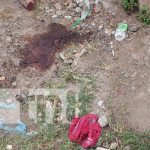 Con el rostro desfigurado y pura sangre: Malmatan a un hombre en Boaco Foto: Agreden de forma salvaje a un hombre en Boaco / TN8