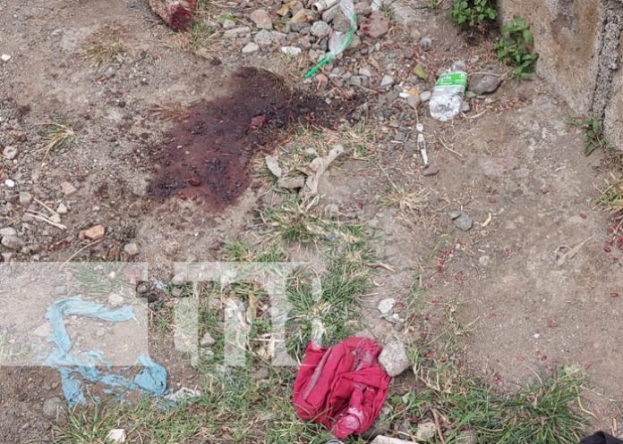 Foto: Agreden de forma salvaje a un hombre en Boaco / TN8 Foto: Agreden de forma salvaje a un hombre en Boaco / TN8