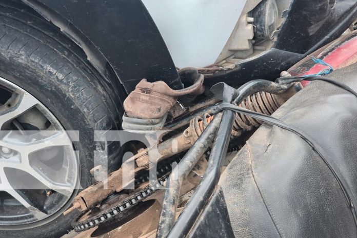 Foto: Accidente de transito deja dos motociclistas lesionados en Juigalpa/TN8