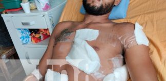Foto: Víctima lucha por su vida tras violento ataque en Rivas/TN8
