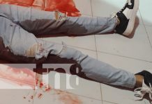 Muerte violenta: A.R.D, víctima de un brutal ataque en Río Blanco Foto: Terrible asesinato en Río San Juan, Matagalpa / TN8