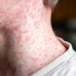 Foto: Foto: Alerta en Estados Unidos /cortesía /cortesía