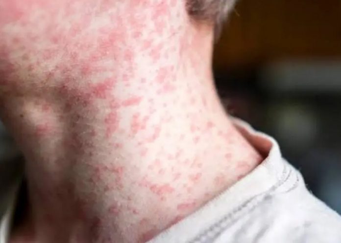 Foto: Foto: Alerta en Estados Unidos /cortesía /cortesía