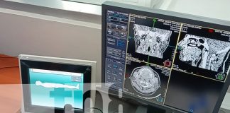 Foto: Bluefields con tecnología de diagnóstico avanzada/TN8