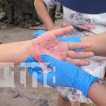 Feroz ataque: Perro cruzado con Pitbull muerde a niña en Estelí Foto: Perro ataca a una niña en Estelí / TN8