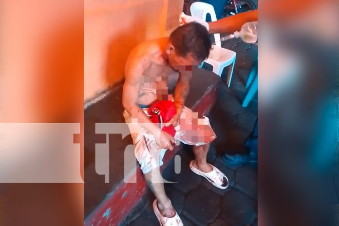 Foto: ¡Por poco y no lo cuenta! Sujeto es brutalmente golpeado con un bate en Managua/TN8