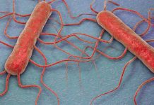 Brote de listeria sacude EE.UU., alimentos contaminados dejan 10 hospitalizados Foto: Al menos 10 personas se contagian de listeria /Cortesía