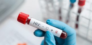 Foto: Filipinas vertiginoso aumento de casos de VIH/Cortesía