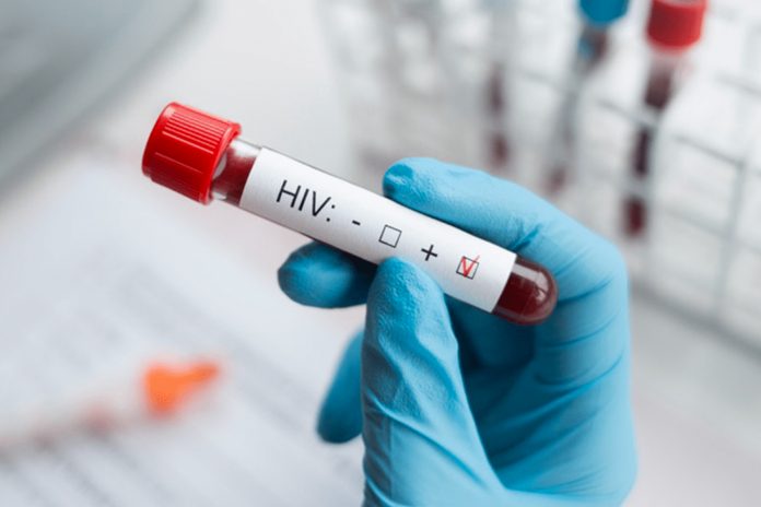 Foto: Filipinas vertiginoso aumento de casos de VIH/Cortesía Foto: Filipinas vertiginoso aumento de casos de VIH/Cortesía