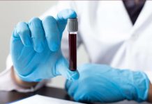 Científicos crean sangre artificial compatible con todos los grupos sanguíneos Foto: Científicos desarrollan sangre artificial /Cortesía