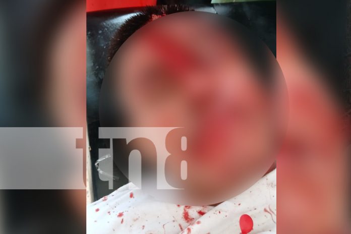 Foto: Motociclista ebrio termina con el rostro desfigurado tras accidente en Ometepe/TN8