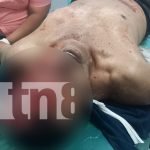 Grave accidente en Estelí: al menos 8 afectados, un fallecido y un semoviente muerto Foto: Grave accidente en Estelí: al menos 8 afectados, un fallecido y un semoviente muerto/TN8