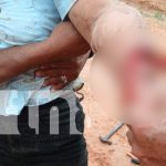 Foto: Mujer sufre graves lesiones en Wiwas/TN8